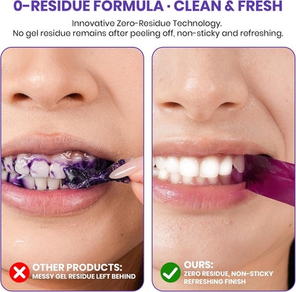 Purple Teeth Whitening Strips | Professional Teeth Whitening & Color Correction Tech | Enamel Safe | Zero Residue | Dry & Non-Slip | Removes Coffee, Wine & Smoking Stains | 14 Strips 7-Day Supply