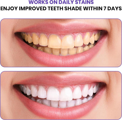 Purple Teeth Whitening Strips | Professional Teeth Whitening & Color Correction Tech | Enamel Safe | Zero Residue | Dry & Non-Slip | Removes Coffee, Wine & Smoking Stains | 14 Strips 7-Day Supply